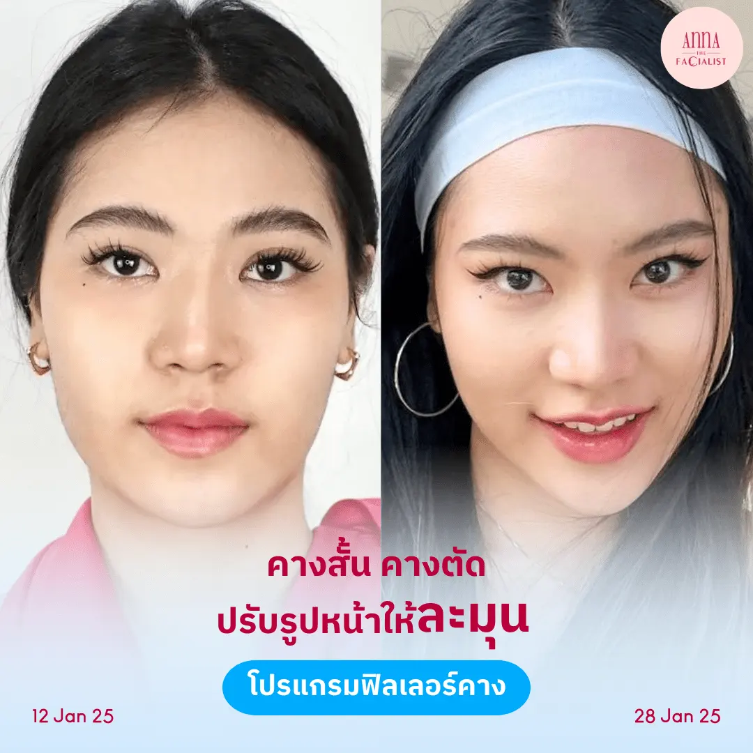 facial-design-00002-005