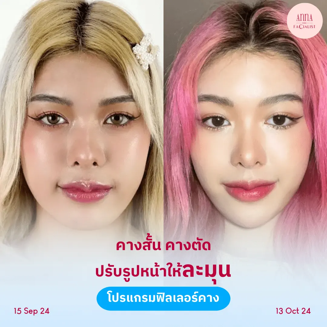 facial-design-00002-006