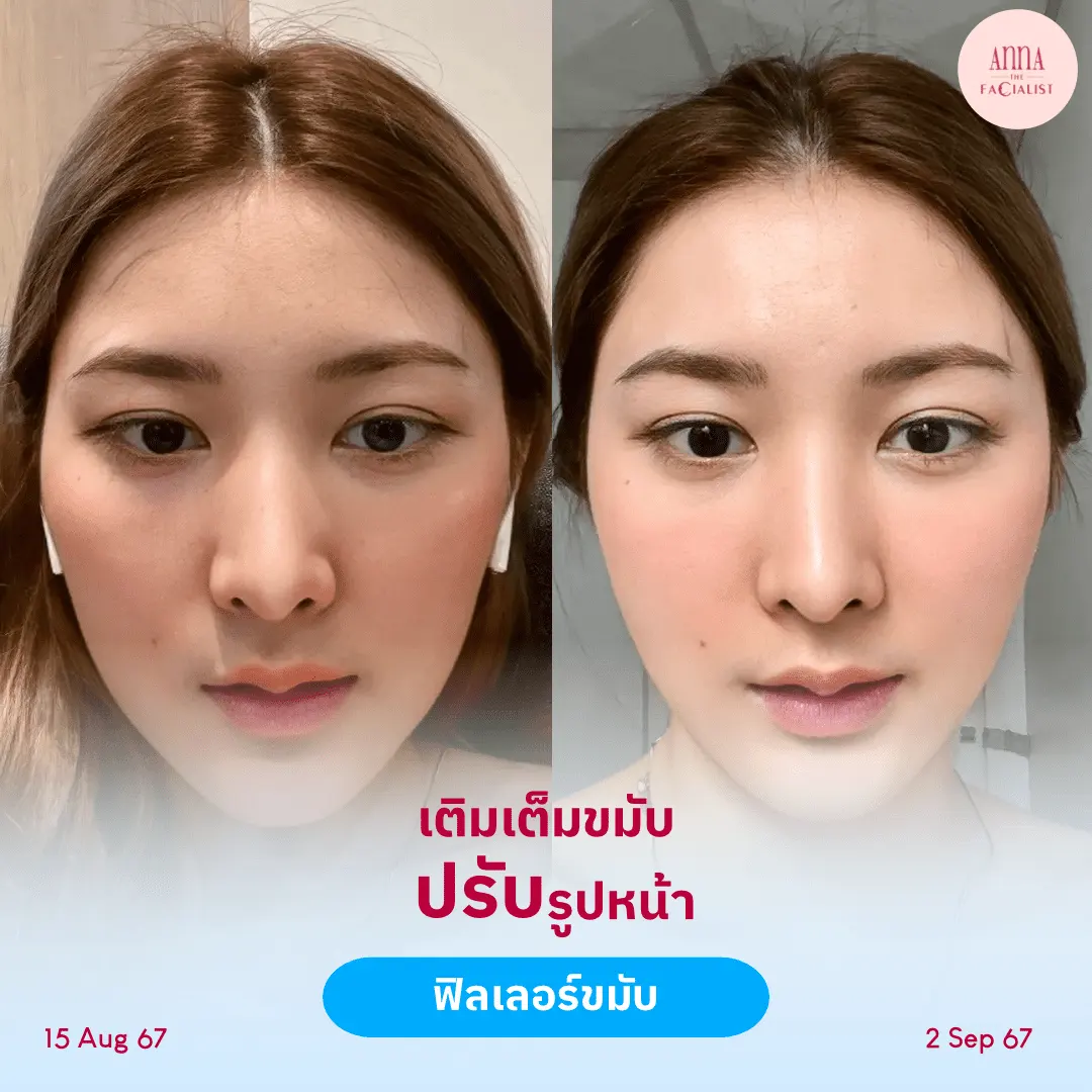 facial-design-00002-007