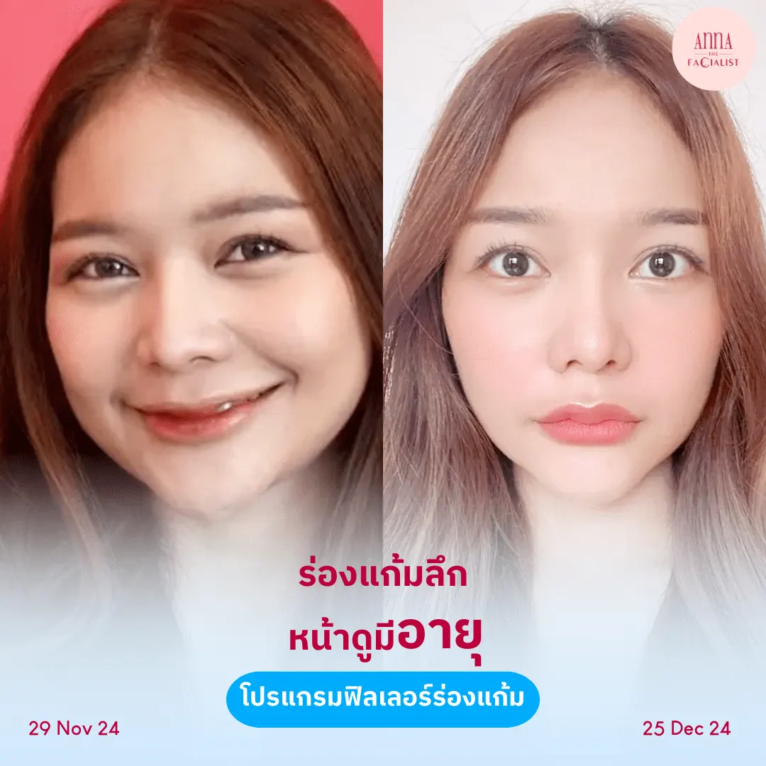 facial-design-00002-009