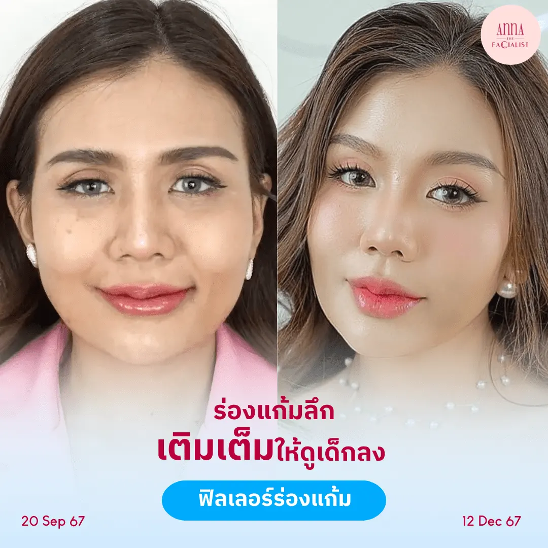 facial-design-00002-010