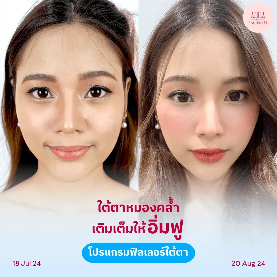 facial-design-00002-013