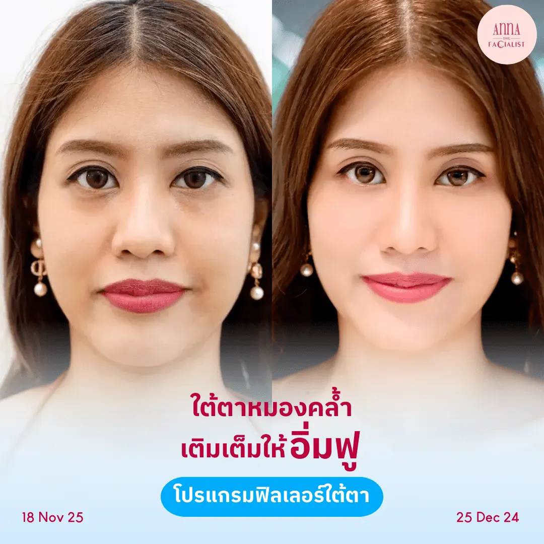 facial-design-00002-014