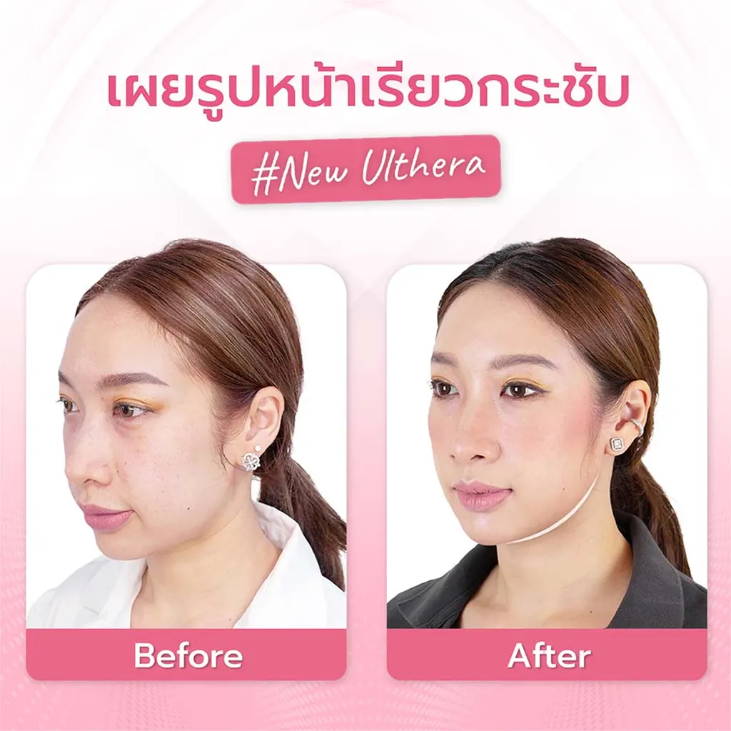 facial-design-00003-005