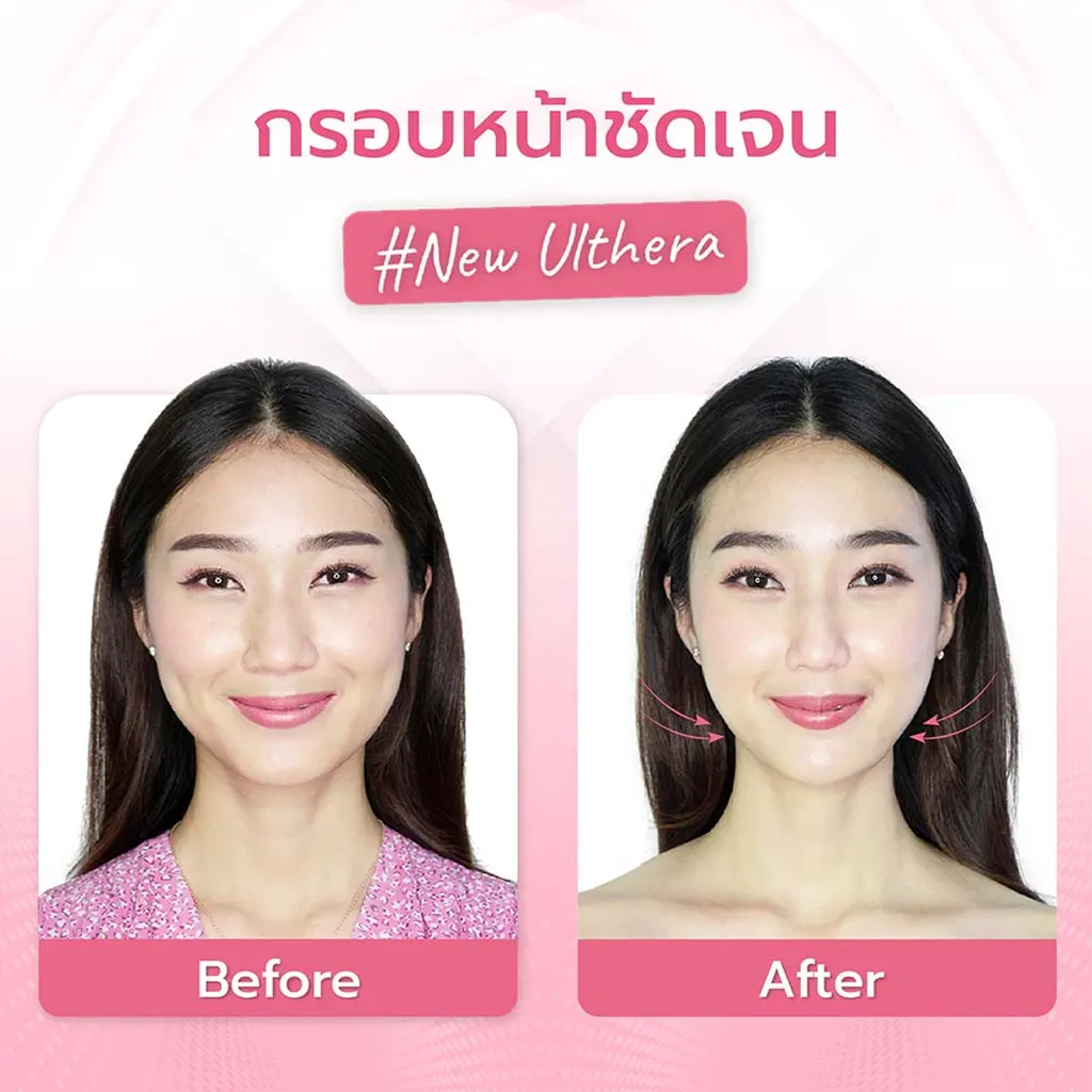 facial-design-00003-006