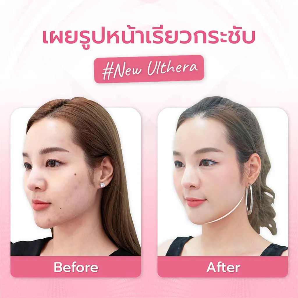 facial-design-00003-007