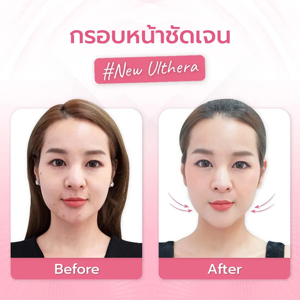 facial-design-00003-008