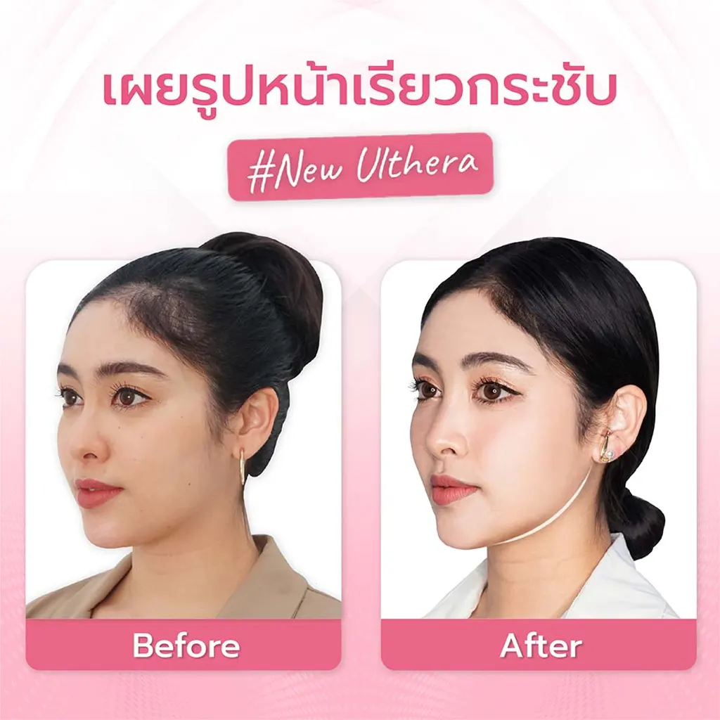 facial-design-00003-009