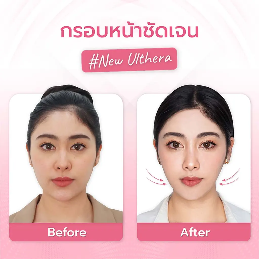 facial-design-00003-010