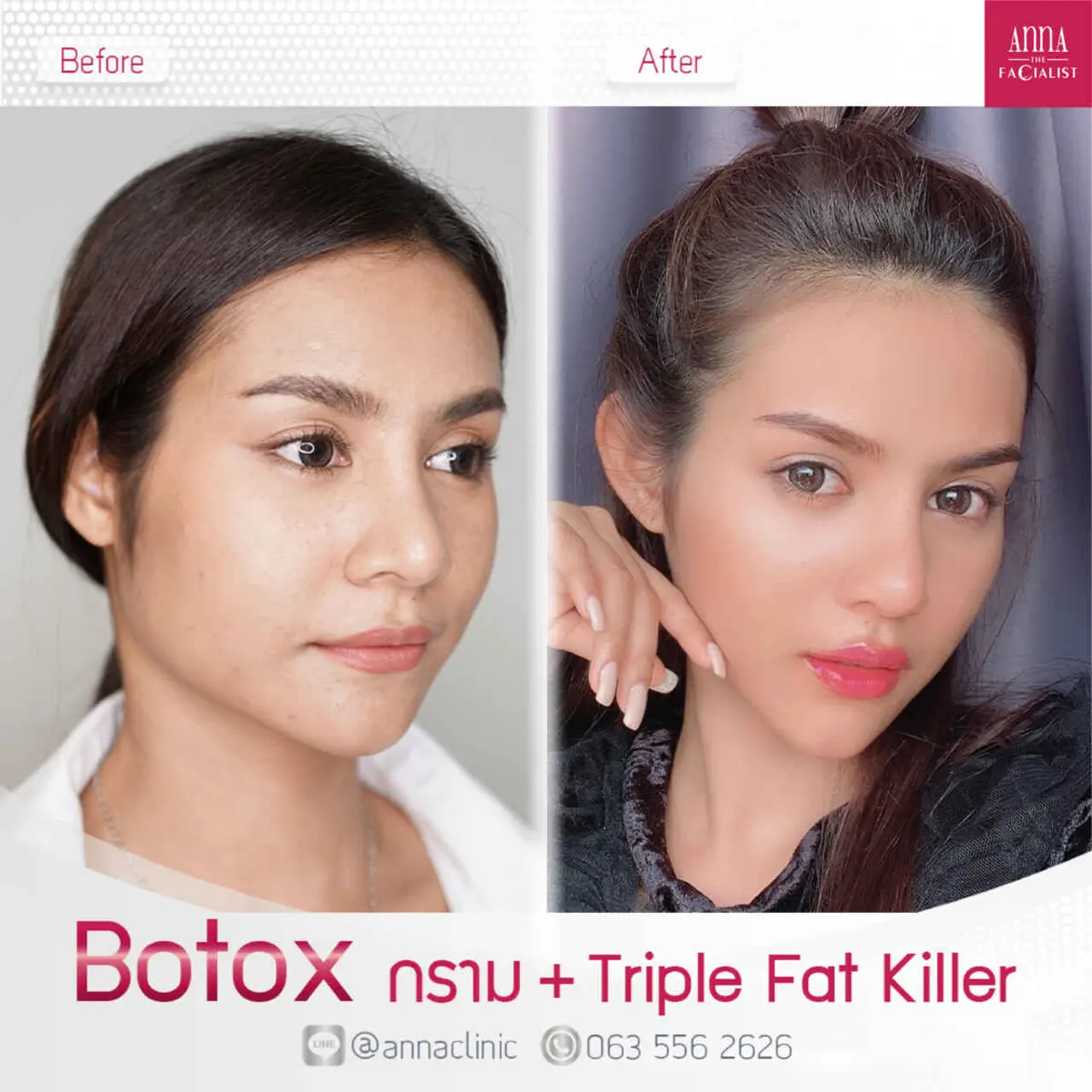 triple-fat-killer-00003