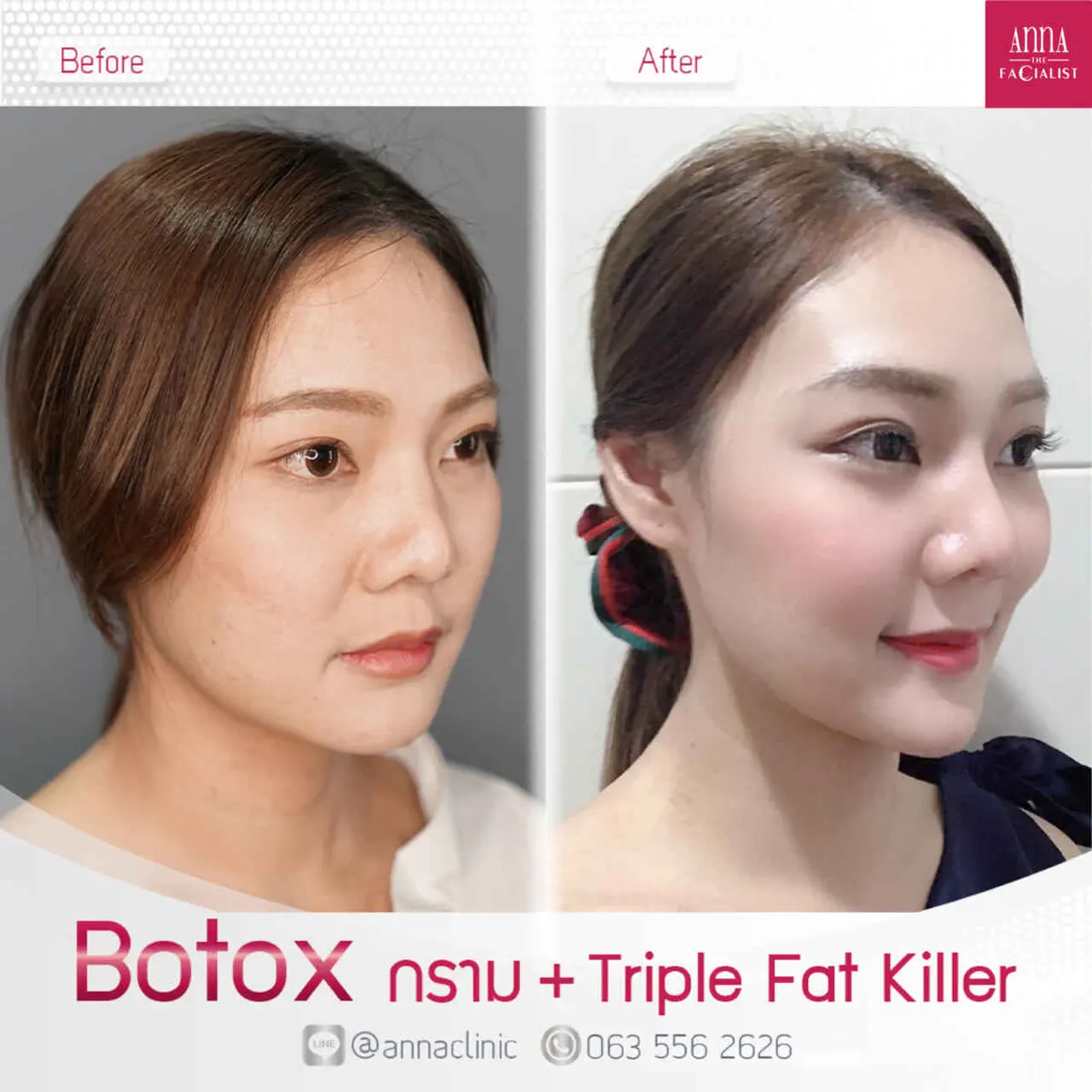 triple-fat-killer-00004