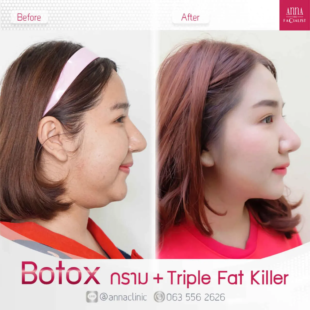 triple-fat-killer-00005