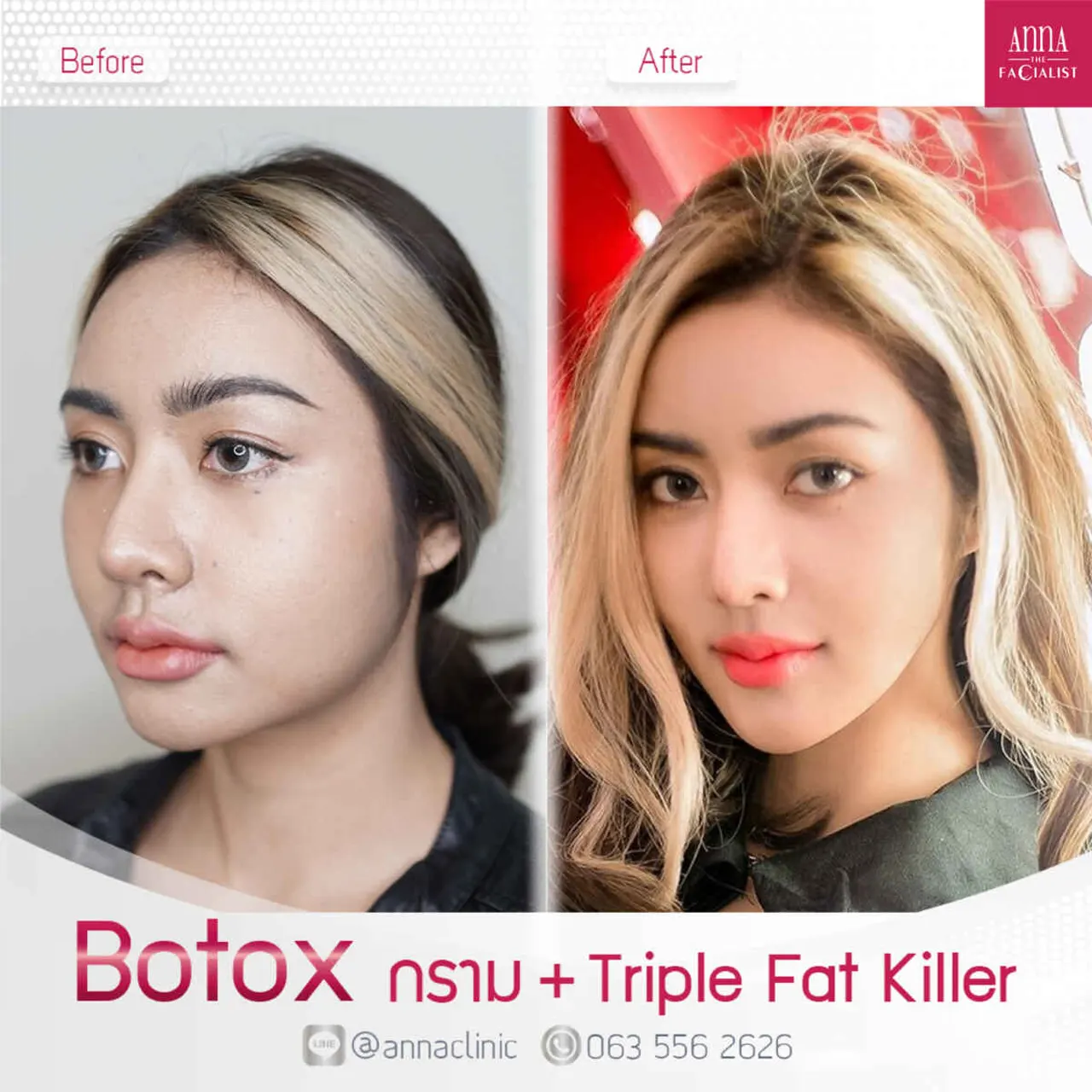 triple-fat-killer-00006