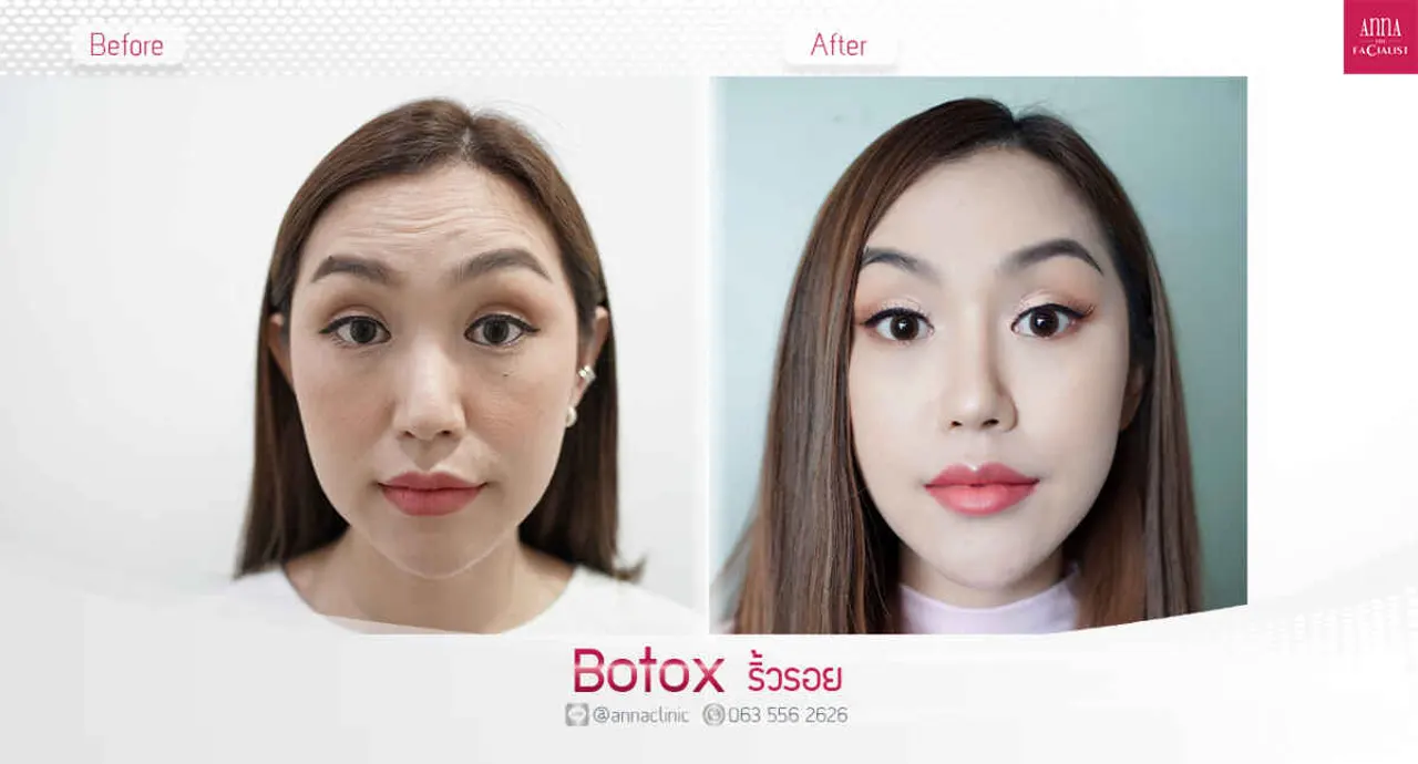 triple-fat-killer-00007