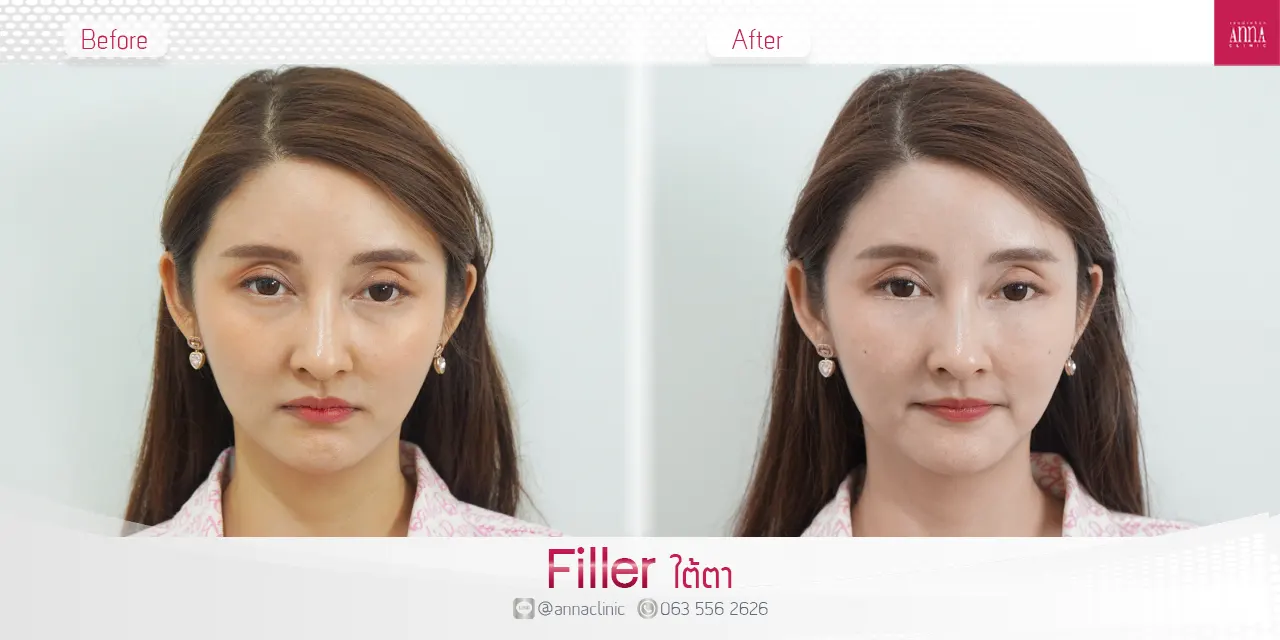 triple-fat-killer-00012