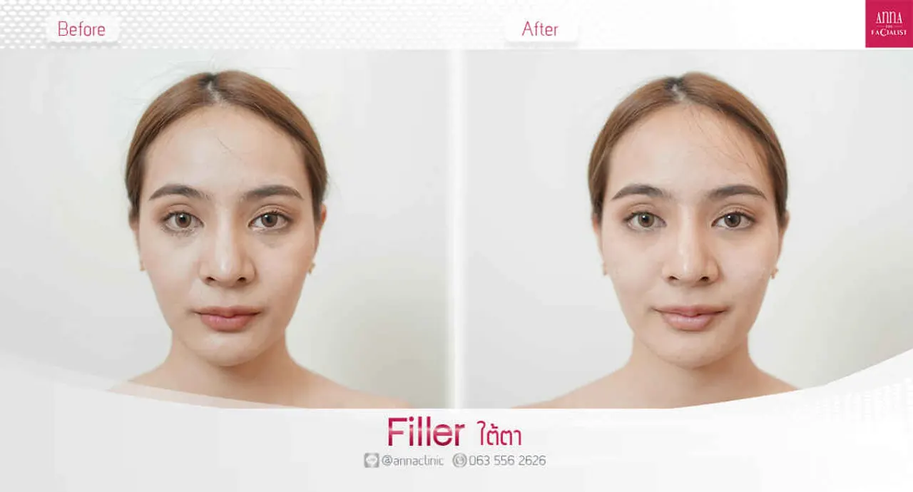 triple-fat-killer-00013