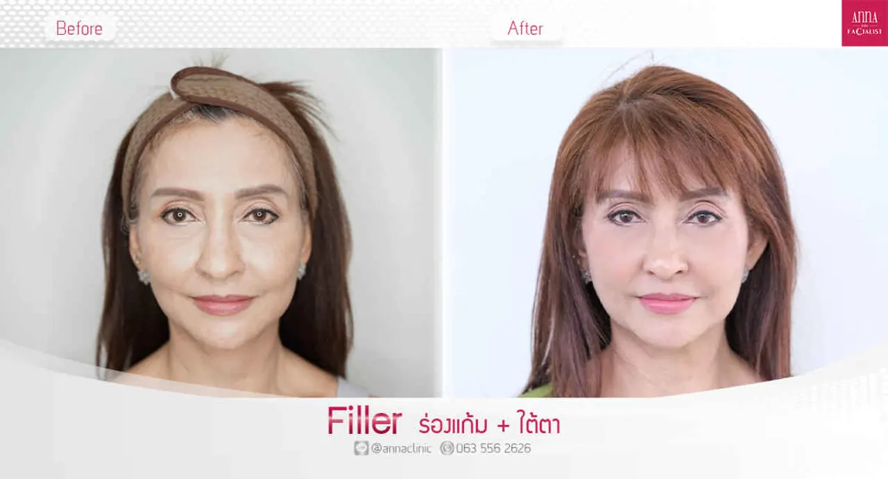 triple-fat-killer-00016