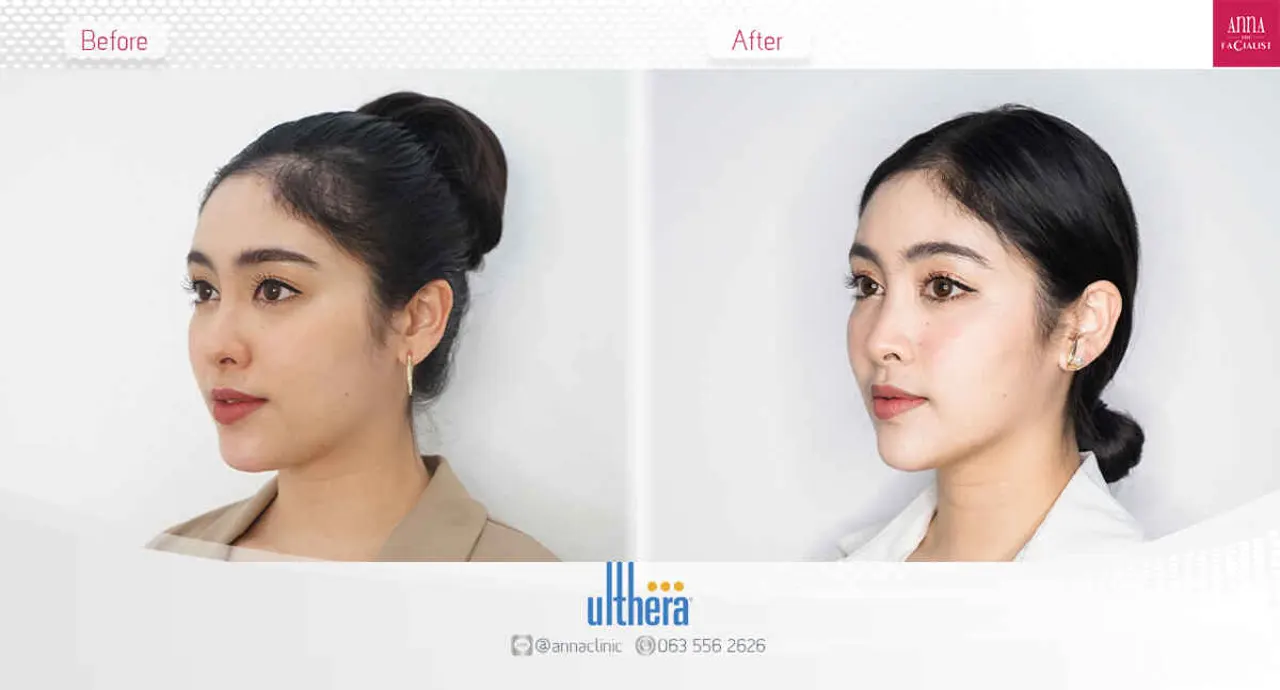 triple-fat-killer-00018